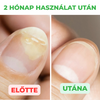 Aktív megoldás köröm és a bőr kezelésére, 30 ml