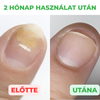 Aktív megoldás köröm és a bőr kezelésére, 30 ml